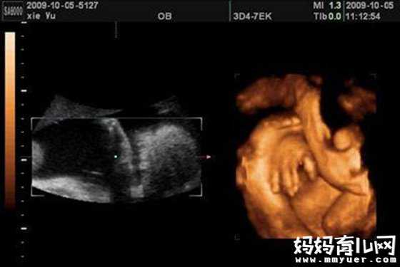 湖北代孕中心供卵_怀孕七个月胎儿图解秘孕晚期胎宝宝的发育状况